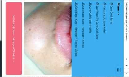 Captura 8 Cold Sore Cure Free App with Natural Remedies windows
