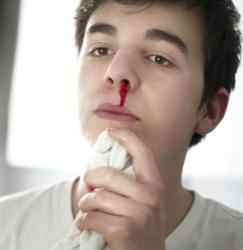 Captura 3 Nose Bleeding Remedies android