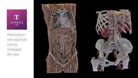 Captura 7 Virtual Cadaver Anatomy Lab - Athena Hub windows