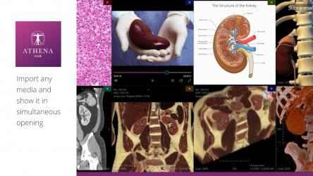 Imágen 9 Virtual Cadaver Anatomy Lab - Athena Hub windows