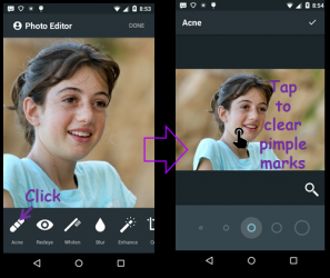 Captura 3 Acné Remover Photo Editor App android