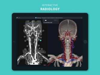 Screenshot 12 Complete Anatomy ‘21 - 3D Human Body Atlas android