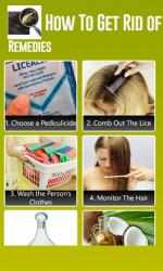 Image 1 How To Get Rid of Head Lice windows