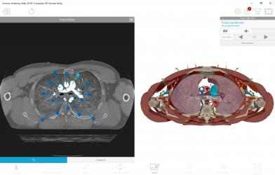 Captura 2 Atlas de anatomía humana 2019: Cuerpo humano completo en 3D windows
