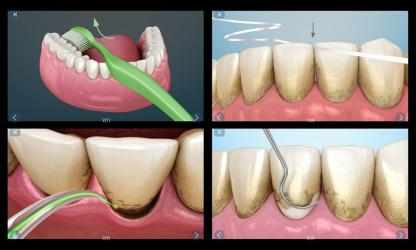 Captura de Pantalla 14 Ilustraciones dentales para consultar al paciente android
