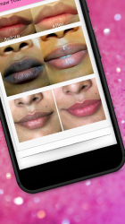 Imágen 4 Lips Care - 13 Home Remedies To Get Soft Pink Lips android