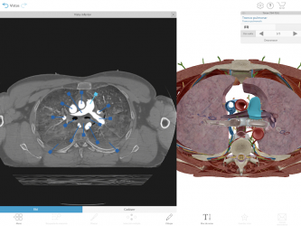 Captura de Pantalla 14 Atlas de anatomía humana 2021: el cuerpo en 3D  android